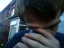 Blueade in the eye