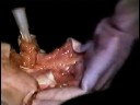 Hand23