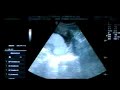 16 Week ultrasound - long version 16 Week ultrasound - long version