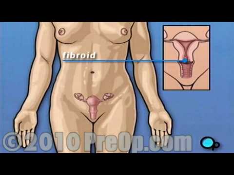 vagina