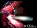 To learn more visit: http://www.or-live.com/NMH/2259/index.cfm?cmpid=youtube2259