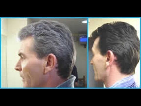 how to get rid grey hair