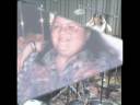 Carol Dierking - Before / After Gastric Bypass Surgery