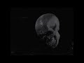 Boys Noize - Oi Oi Oi Album Promo