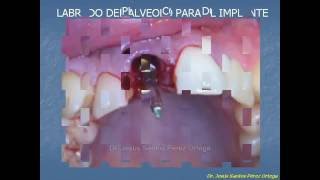 Jesus Santos Perez Ortega-6