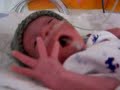 Jack Awake CPAP Device