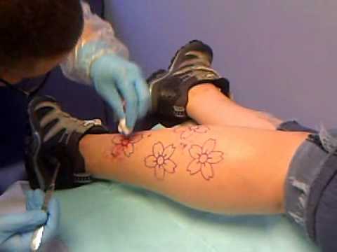 how to perform scarification