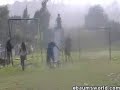 Another playground accident (grown up) Another playground accident (grown up)