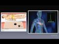 videos de ECG in de huisartsenpraktijk