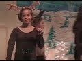 EMILY DOWN SYNDROME DANCER  Birth Defects Down Syndrome