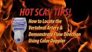Locating the Vertebral Artery and Demonstrating Flow Direction Using Color Doppler