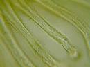 bryozoaire