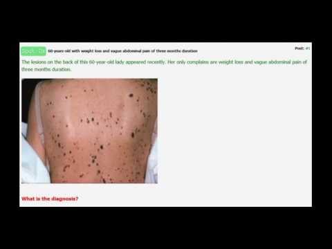 how to diagnosis a skin rash