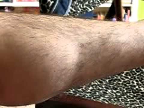 how to cure twitching