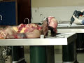 Autopsia Capitulo 7