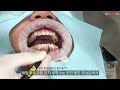 주상돈박사 치과의사들을 대상으로 치주교정 강연진행합니다.