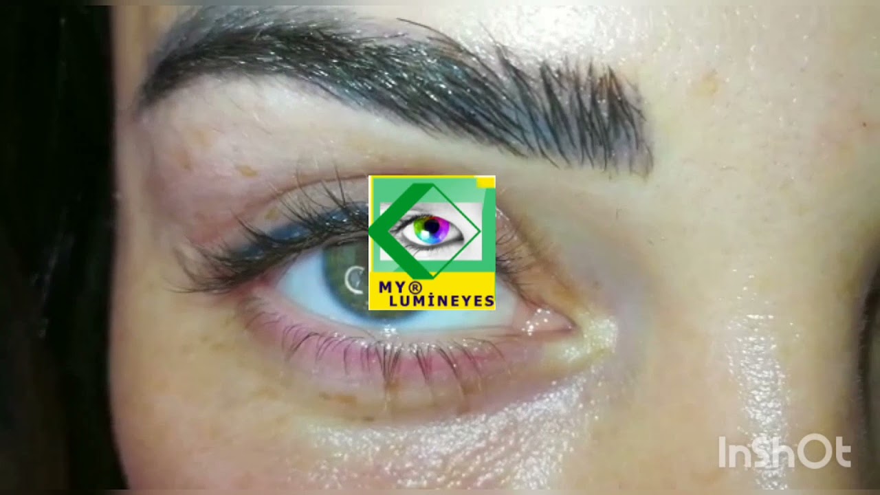 changez la couleur de vos yeux meilleure technologie laser par Dr.Mete