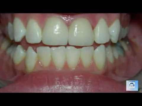 Cosmetic Dentist Los Angeles