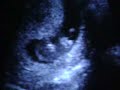 Baby in the belly