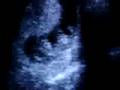 Baby in the belly