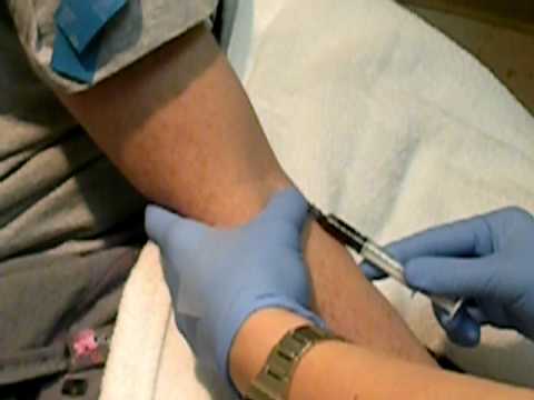 how to administer remicade