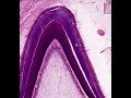 Shotgun Histology Tooth Eruption