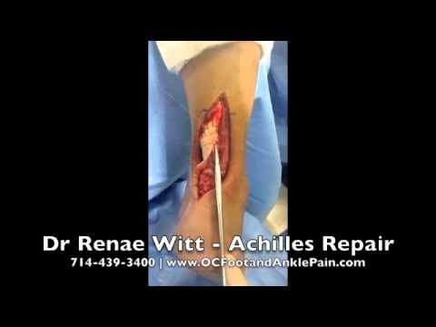 how to repair dpm 2012