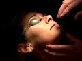 Live Webcast: Non-Surgical Aesthetic Lasers