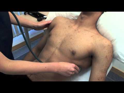 how to assess vocal fremitus