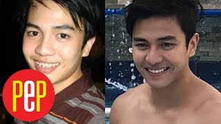 Jak Roberto on nose job rumor:  Puwede naman 