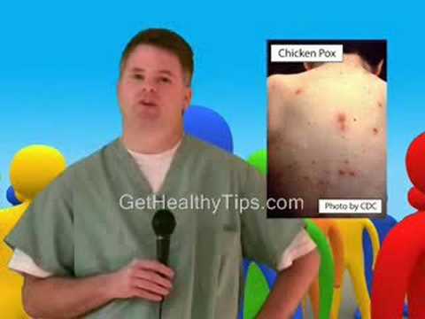 how to treat chicken pox