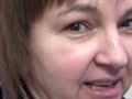 DALLAS FEMALE HAIR TRANSPLANT: DEBBIE\ DALLAS FEMALE HAIR TRANSPLANT: DEBBIE\