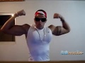 Synthol Abuse definitely not a bodybuilder RODRIGO FERRAZ