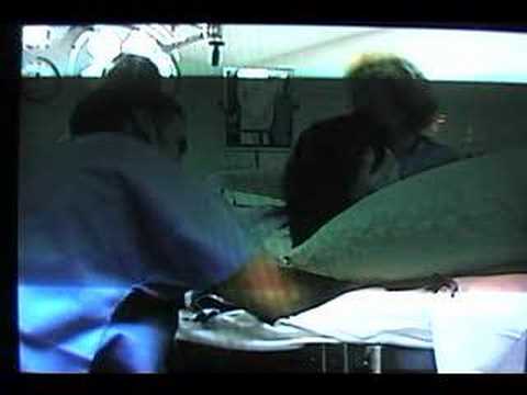 Natural Birth of Twins