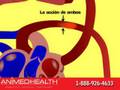 La Hipertensión Arterial - Animed Health