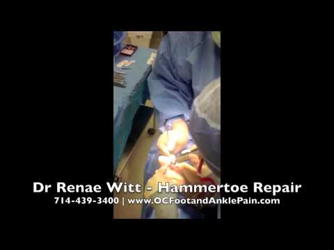 how to repair dpm 2012