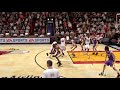 Nba Kobe Ankle Broken Nba Kobe Ankle Broken