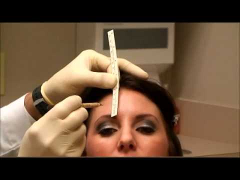 Botox Injection by Facial Plastic Surgeon Brian P Maloney in Atlanta Georgia