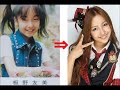 AKB48 整形したメンバー 川上未映子