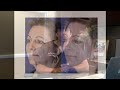 Dr. Amiya Prasad on miXto SX Micro Fractional CO2 Laser Treatment.m4v