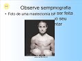 Câncer de Mama... Prevenir é o Alvo!