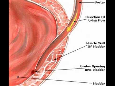 how to control urine infection