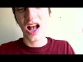 Thumbnail #2
