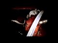 Magenband - ambulant - Adipositaschirurgie-gastric banding Magenband - ambulant - Adipositaschirurgie-gastric banding