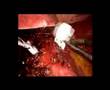 Magenband-ambulant-A