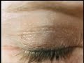 Acuvue Advance for Astigmatism