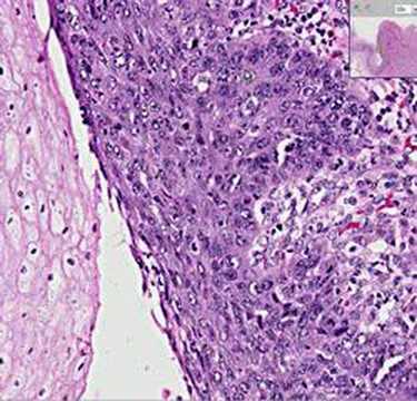 Histopathology Esophagus--Squamous ...