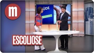Ortopedista fala sobre os mitos e verdades da escoliose
