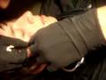 videos de Dermal anchor x2