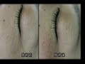 Dr.sato??????????? Massage that wrinkle improves in dramatic??????